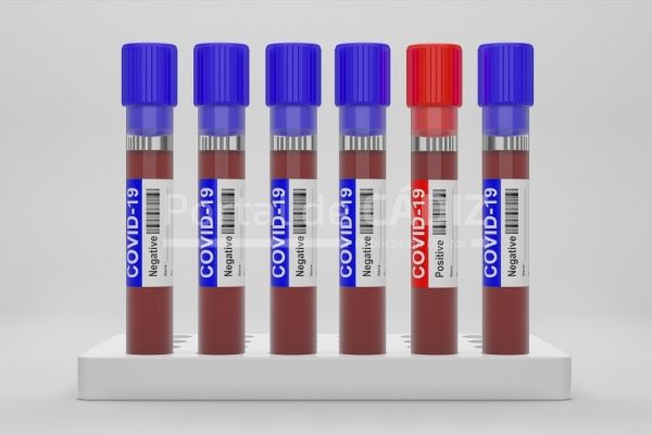3d rendering blood and plasma in test tubes that have been analyzed for covid 19 2019 ncov or t20 yearrm