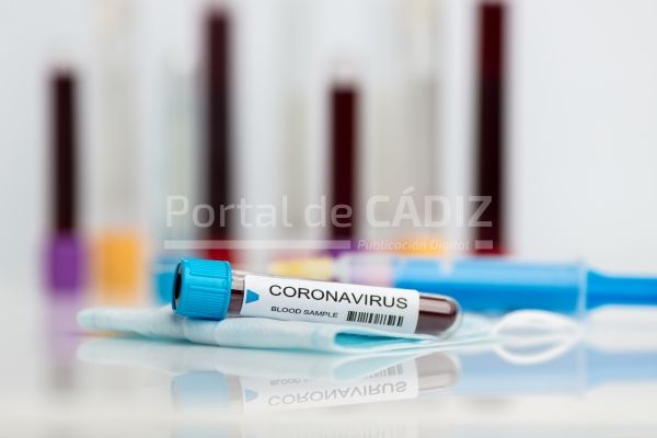 laboratory sample of the novel coronavirus zk5eetq